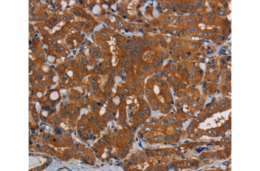 Immunohistochemistry - PDE5A Antibody from Signalway Antibody (37810) - Antibodies.com