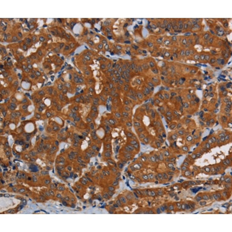 Immunohistochemistry - PDE5A Antibody from Signalway Antibody (37810) - Antibodies.com