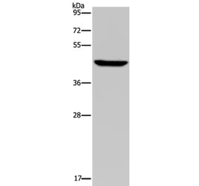 PDSS2 Antibody from Signalway Antibody (37812) - Antibodies.com
