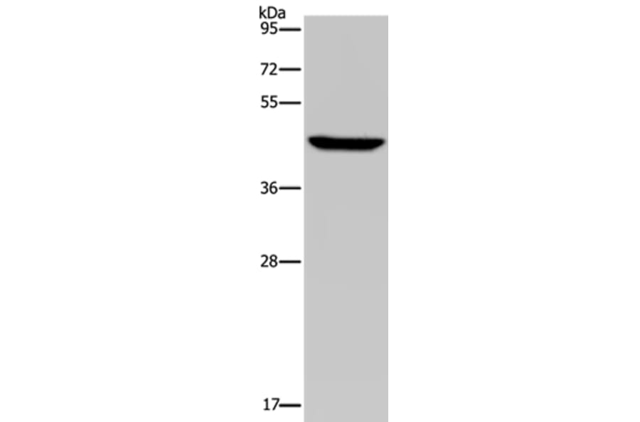PDSS2 Antibody from Signalway Antibody (37812) - Antibodies.com