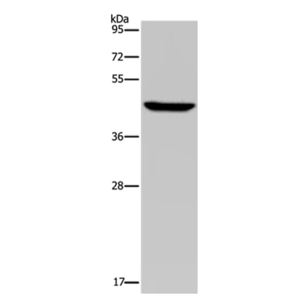 PDSS2 Antibody from Signalway Antibody (37812) - Antibodies.com