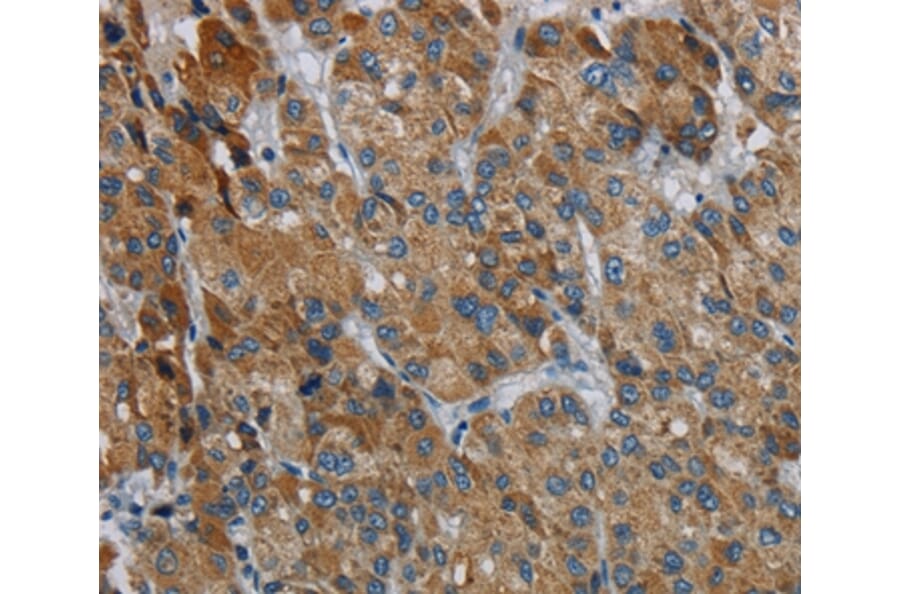 Immunohistochemistry - PDSS2 Antibody from Signalway Antibody (37812) - Antibodies.com