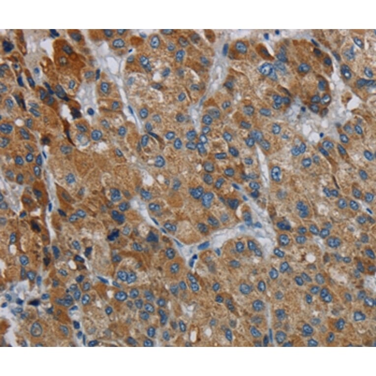 Immunohistochemistry - PDSS2 Antibody from Signalway Antibody (37812) - Antibodies.com