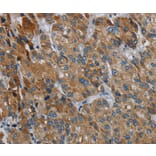 Immunohistochemistry - PDSS2 Antibody from Signalway Antibody (37812) - Antibodies.com
