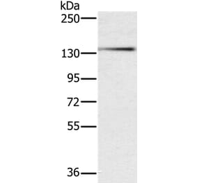 PHKA1 Antibody from Signalway Antibody (37822) - Antibodies.com