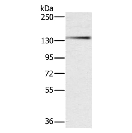 PHKA1 Antibody from Signalway Antibody (37822) - Antibodies.com