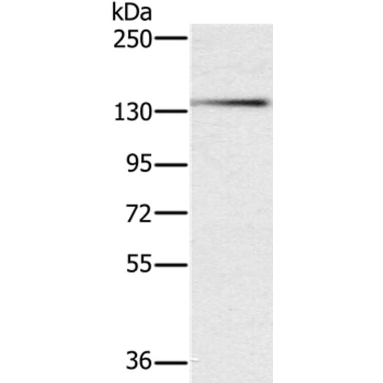 PHKA1 Antibody from Signalway Antibody (37822) - Antibodies.com