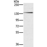 PHKA1 Antibody from Signalway Antibody (37822) - Antibodies.com