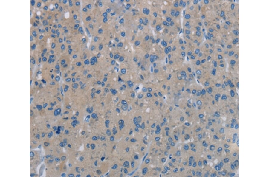 Immunohistochemistry - PHKA1 Antibody from Signalway Antibody (37822) - Antibodies.com