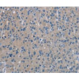 Immunohistochemistry - PHKA1 Antibody from Signalway Antibody (37822) - Antibodies.com