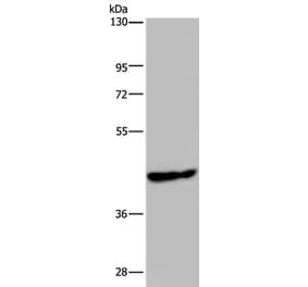 PHKG1 Antibody from Signalway Antibody (37824) - Antibodies.com