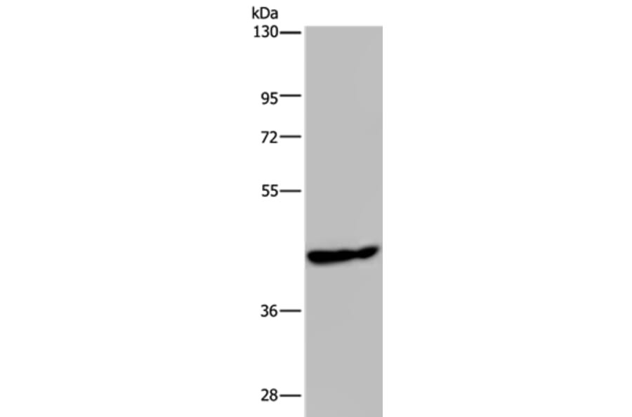 PHKG1 Antibody from Signalway Antibody (37824) - Antibodies.com