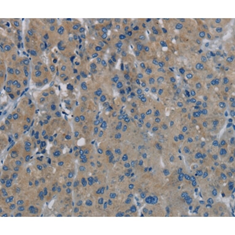 Immunohistochemistry - PHKG1 Antibody from Signalway Antibody (37824) - Antibodies.com