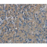 Immunohistochemistry - PHKG1 Antibody from Signalway Antibody (37824) - Antibodies.com