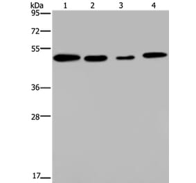 PHKG2 Antibody from Signalway Antibody (37825) - Antibodies.com