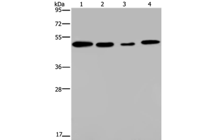 PHKG2 Antibody from Signalway Antibody (37825) - Antibodies.com
