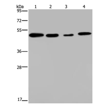 PHKG2 Antibody from Signalway Antibody (37825) - Antibodies.com