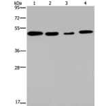 PHKG2 Antibody from Signalway Antibody (37825) - Antibodies.com