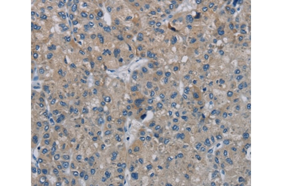 Immunohistochemistry - PHKG2 Antibody from Signalway Antibody (37825) - Antibodies.com