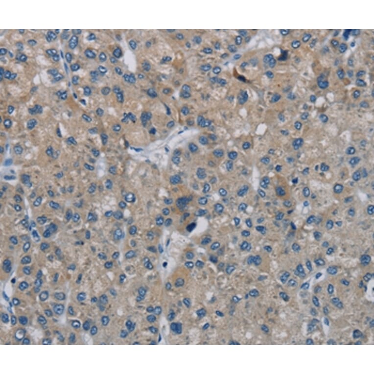 Immunohistochemistry - PHKG2 Antibody from Signalway Antibody (37825) - Antibodies.com