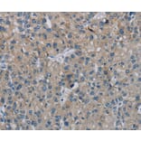 Immunohistochemistry - PHKG2 Antibody from Signalway Antibody (37825) - Antibodies.com