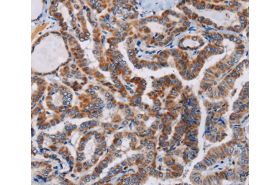 Immunohistochemistry - PLCB3 Antibody from Signalway Antibody (37830) - Antibodies.com