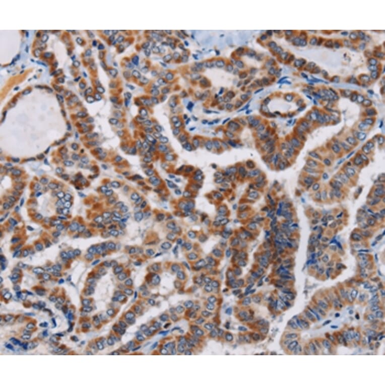 Immunohistochemistry - PLCB3 Antibody from Signalway Antibody (37830) - Antibodies.com