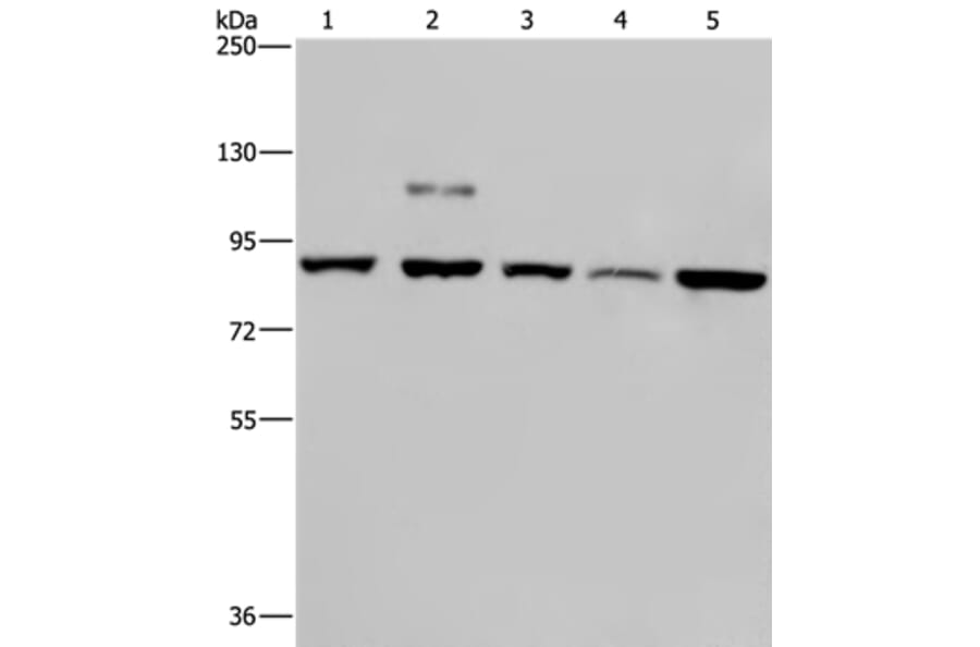 PNPT1 Antibody from Signalway Antibody (37838) - Antibodies.com