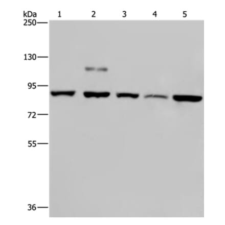 PNPT1 Antibody from Signalway Antibody (37838) - Antibodies.com