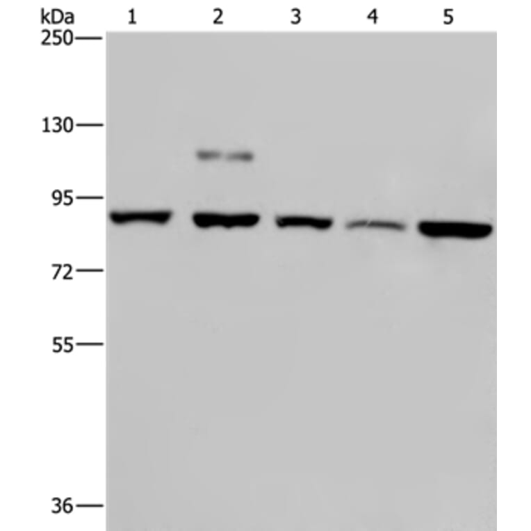 PNPT1 Antibody from Signalway Antibody (37838) - Antibodies.com