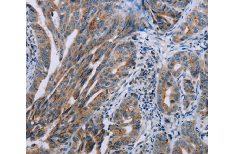 Immunohistochemistry - PNPT1 Antibody from Signalway Antibody (37838) - Antibodies.com