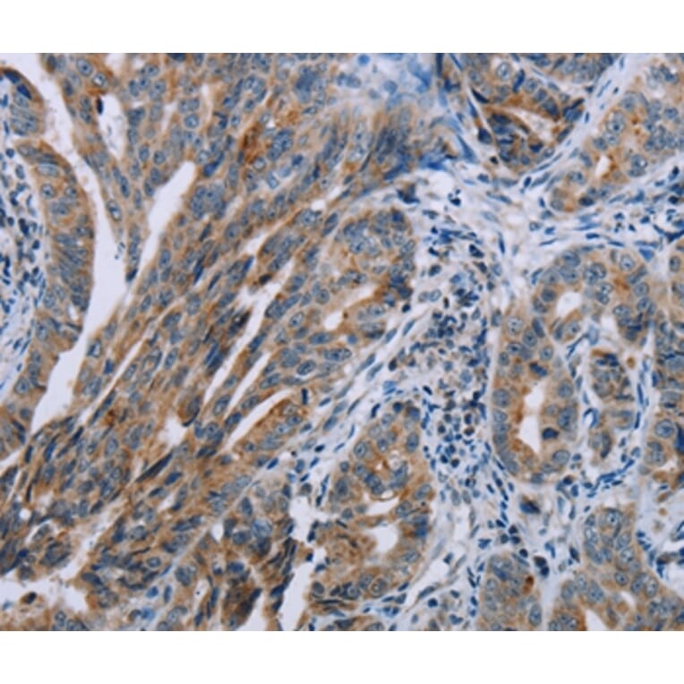 Immunohistochemistry - PNPT1 Antibody from Signalway Antibody (37838) - Antibodies.com