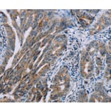 Immunohistochemistry - PNPT1 Antibody from Signalway Antibody (37838) - Antibodies.com