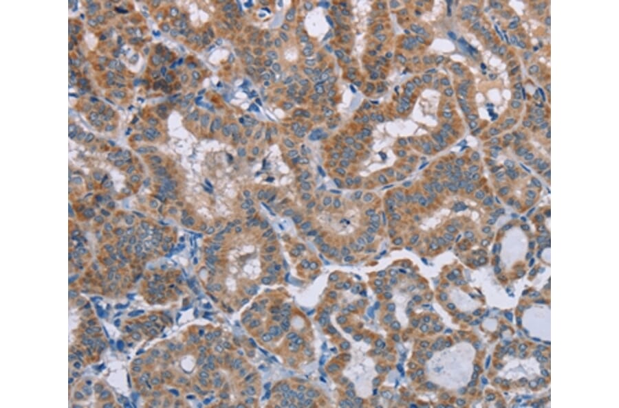 Immunohistochemistry - POMT1 Antibody from Signalway Antibody (37839) - Antibodies.com
