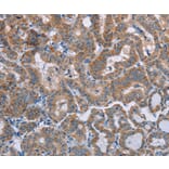 Immunohistochemistry - POMT1 Antibody from Signalway Antibody (37839) - Antibodies.com