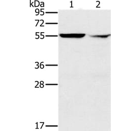 PPM1F Antibody from Signalway Antibody (37843) - Antibodies.com