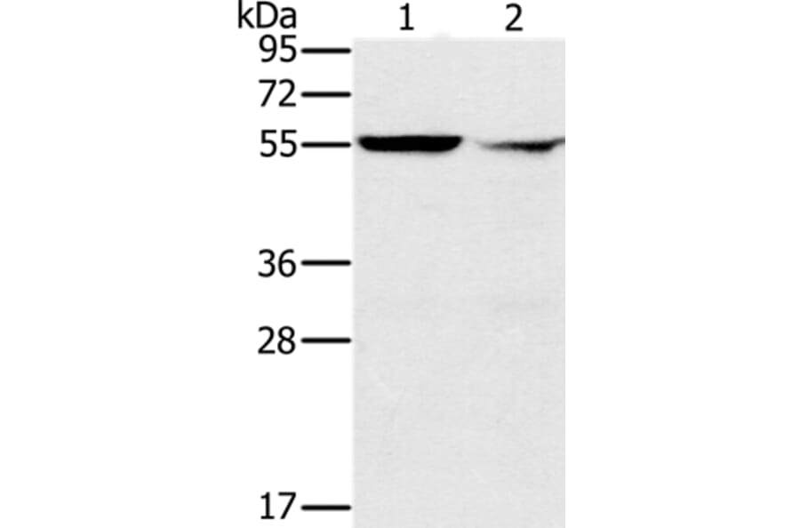 PPM1F Antibody from Signalway Antibody (37843) - Antibodies.com
