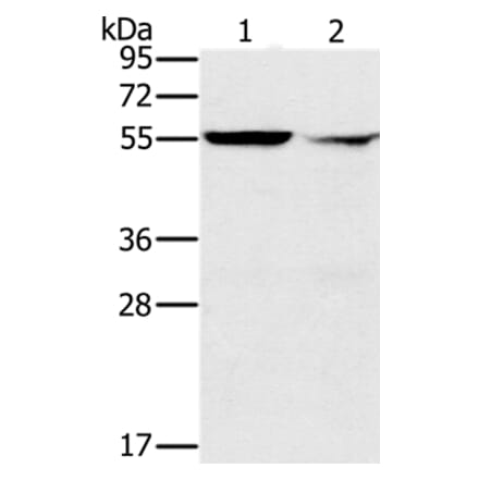 PPM1F Antibody from Signalway Antibody (37843) - Antibodies.com