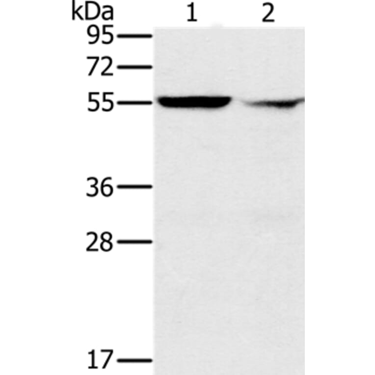 PPM1F Antibody from Signalway Antibody (37843) - Antibodies.com
