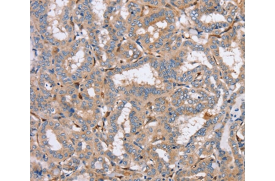 Immunohistochemistry - PPM1F Antibody from Signalway Antibody (37843) - Antibodies.com