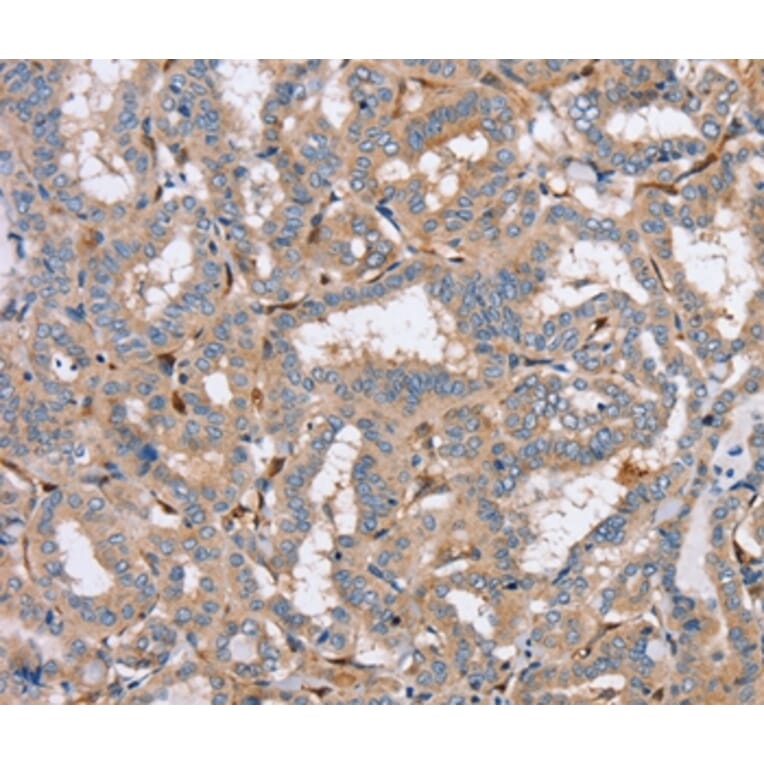 Immunohistochemistry - PPM1F Antibody from Signalway Antibody (37843) - Antibodies.com