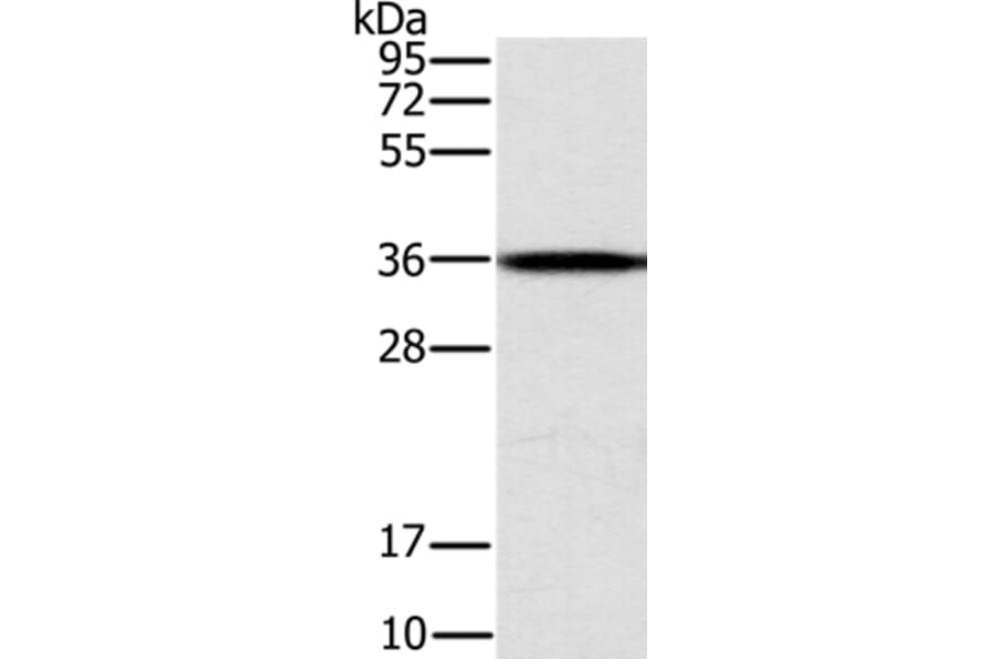 CENPV Antibody from Signalway Antibody (37846) - Antibodies.com