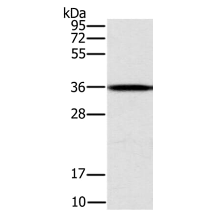 CENPV Antibody from Signalway Antibody (37846) - Antibodies.com