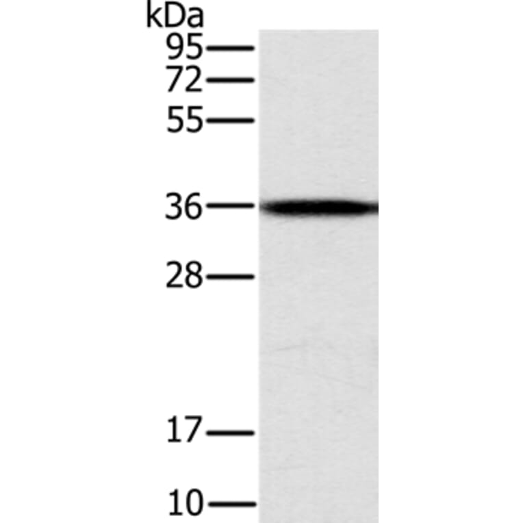 CENPV Antibody from Signalway Antibody (37846) - Antibodies.com