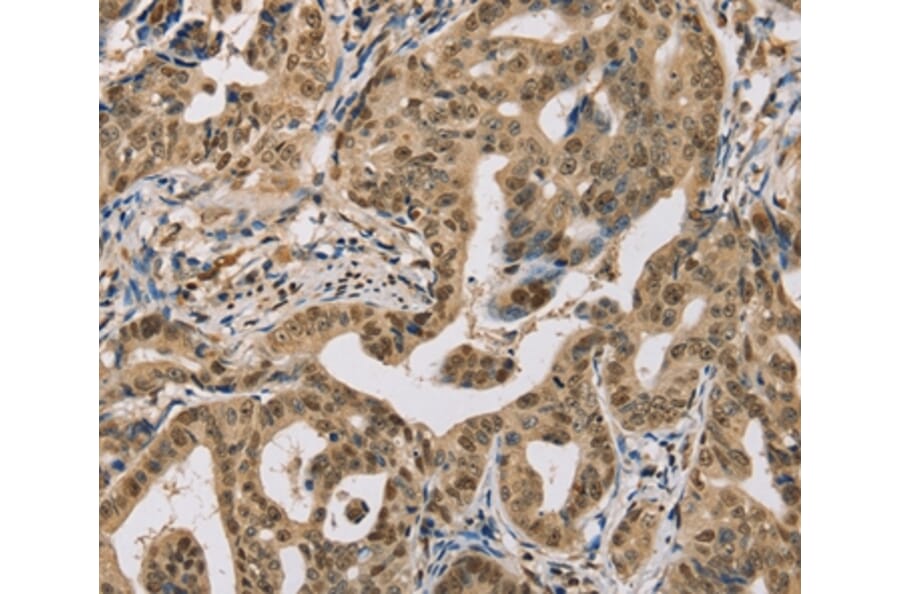 Immunohistochemistry - CENPV Antibody from Signalway Antibody (37846) - Antibodies.com