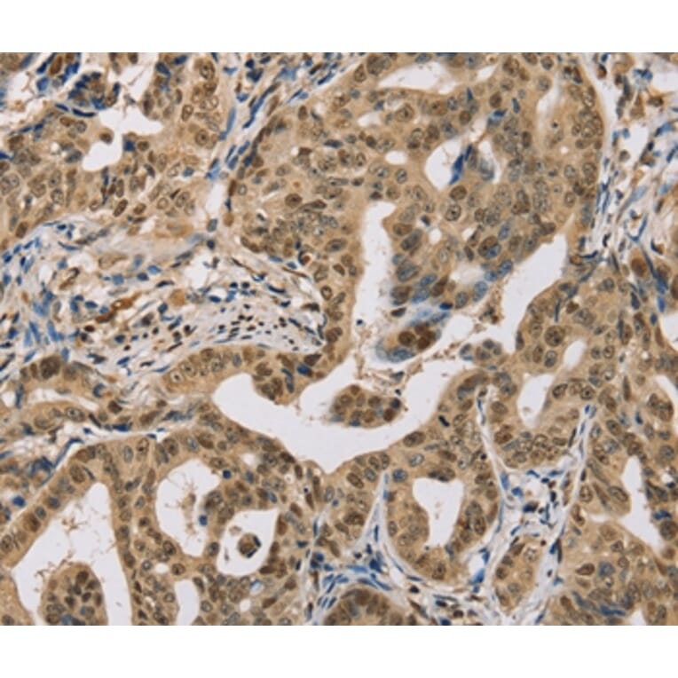 Immunohistochemistry - CENPV Antibody from Signalway Antibody (37846) - Antibodies.com