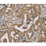Immunohistochemistry - CENPV Antibody from Signalway Antibody (37846) - Antibodies.com