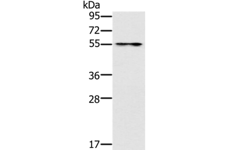 PUS10 Antibody from Signalway Antibody (37852) - Antibodies.com