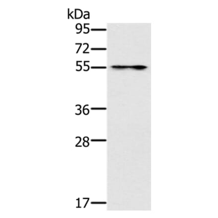 PUS10 Antibody from Signalway Antibody (37852) - Antibodies.com