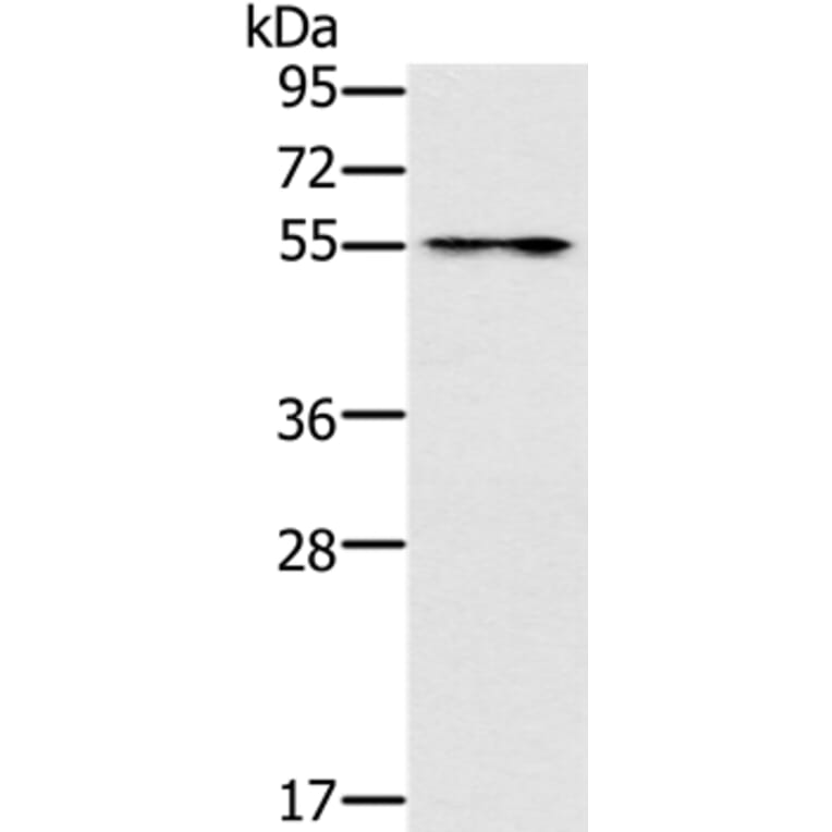 PUS10 Antibody from Signalway Antibody (37852) - Antibodies.com